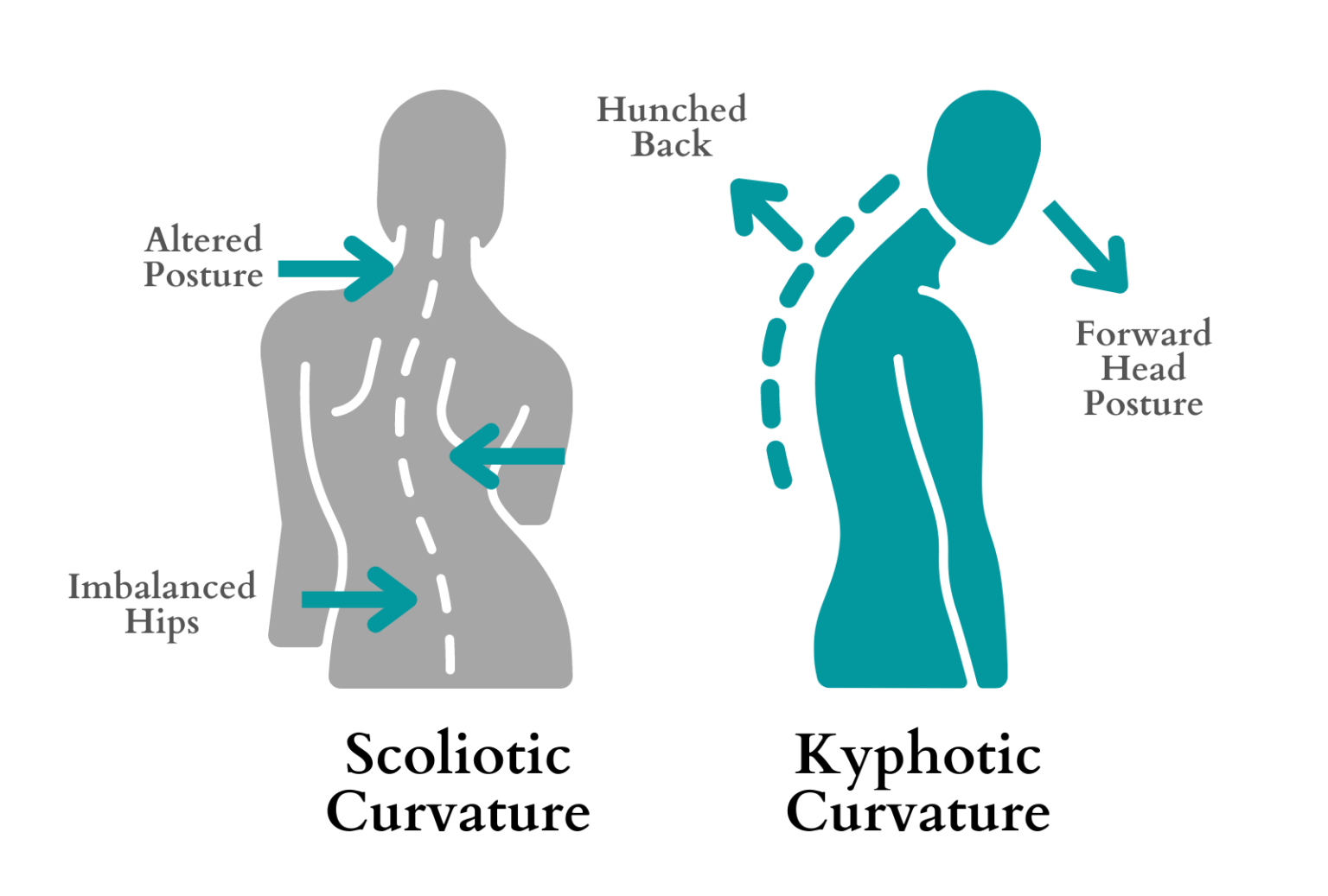 What is the difference between Kyphosis and Scoliosis?