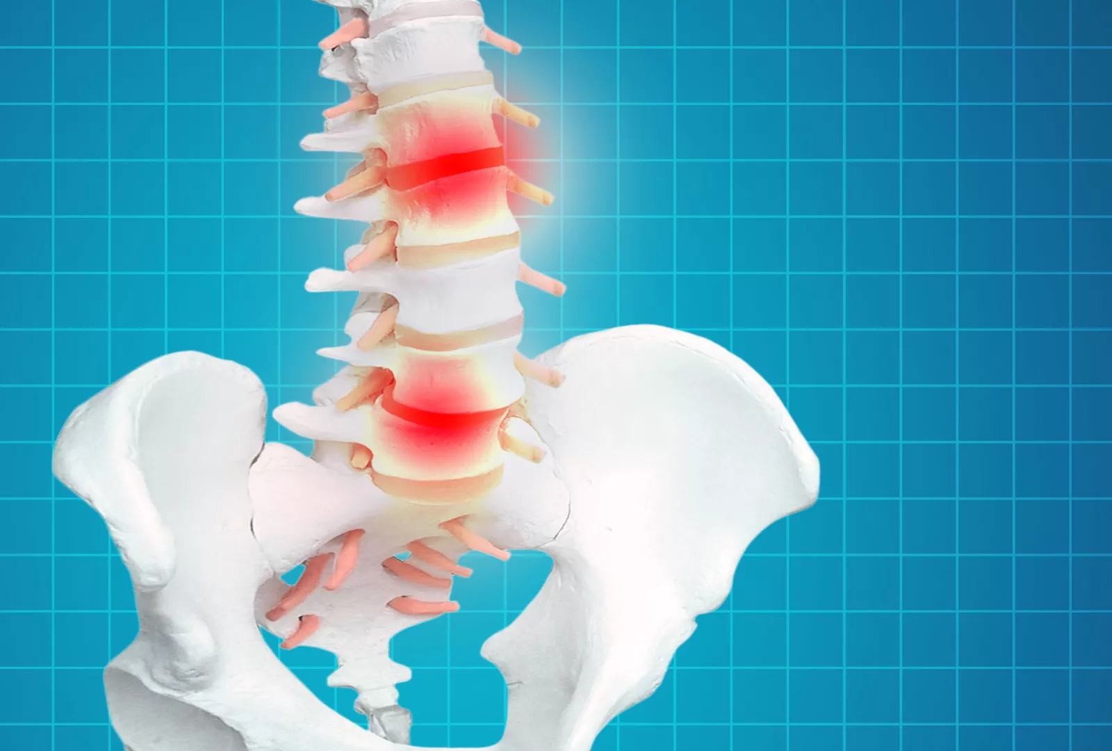 Discitis Back Degenerative Disc Disease Archives Spinal Back Rack
