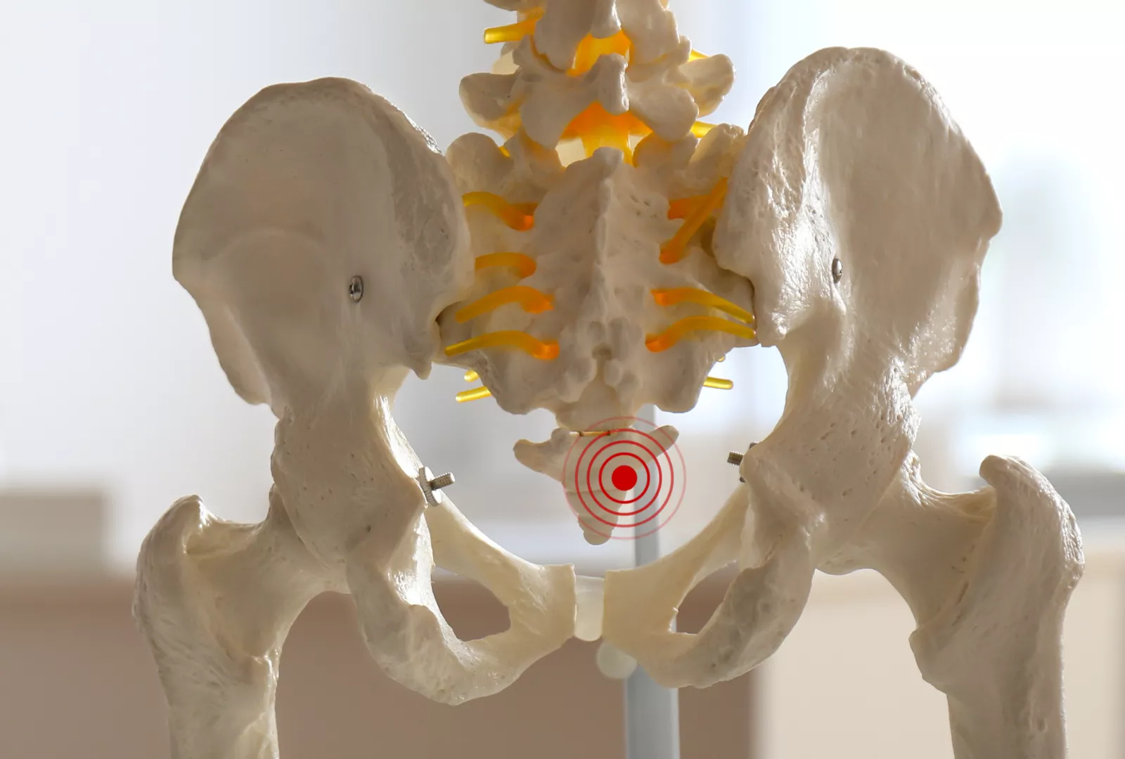 Tailbone Pain Relief without Medicine - Spinal Backrack