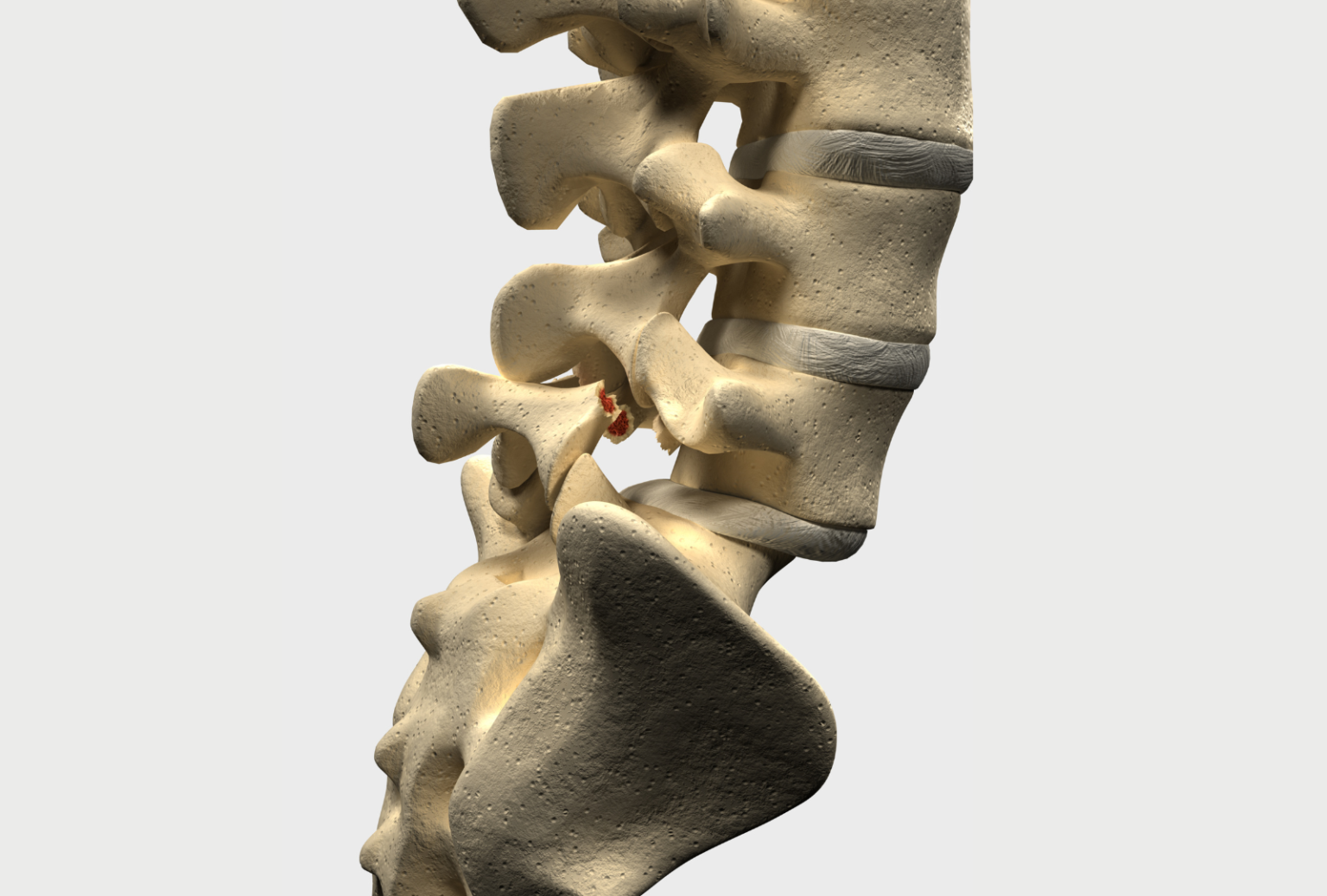 When Your Lower Back Vertebrae Are Out Of Alignment Spinal Backrack