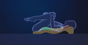 Sciatica Non-Surgical Solution
