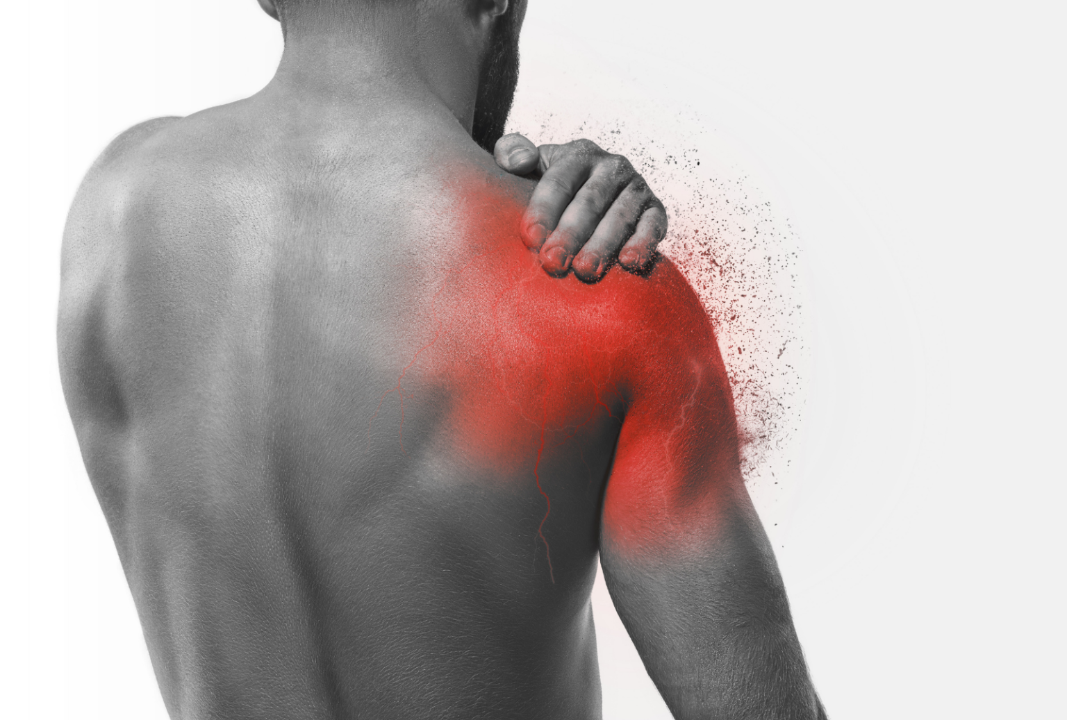 Pinched Nerve in Shoulder Causes and Treatment