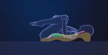 Sciatica Non-Surgical Solution